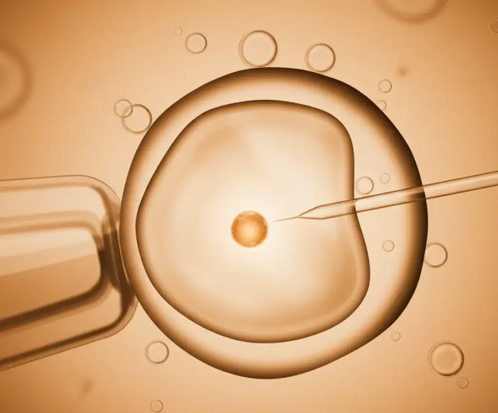 Amparo por Fertilización Asistida 2 fertilizacion asistida